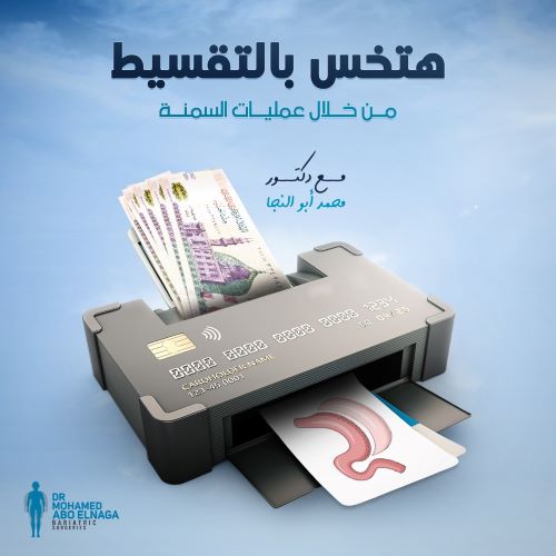 عمليات تحويل المسار بالتقسيط